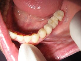 Strach ze zubaře už dávno nepatří do současnosti