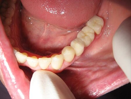 Strach ze zubaře už dávno nepatří do současnosti